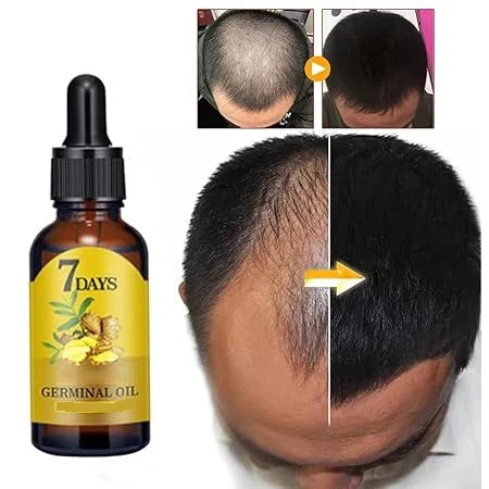 7 Day Ginger Hair Growth Oil (40ml)